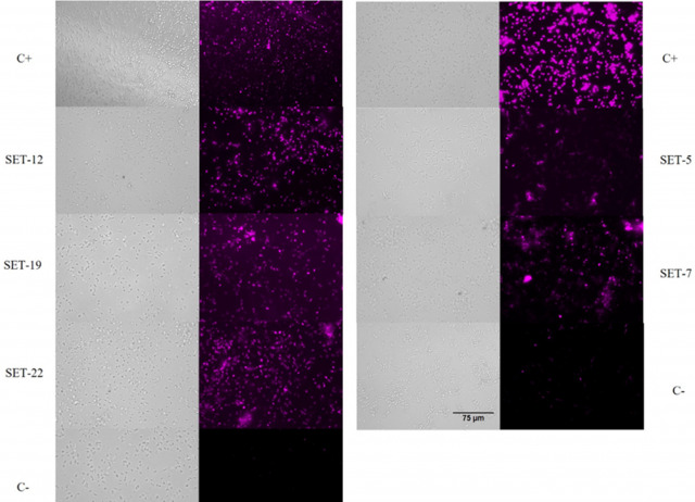 Leishmanicidal and trypanocidal potential of ß,γ-unsaturated carboxylic acid synthetic derivatives